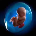 Amniotic-Fluid