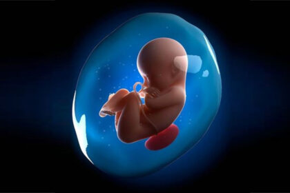 Amniotic-Fluid