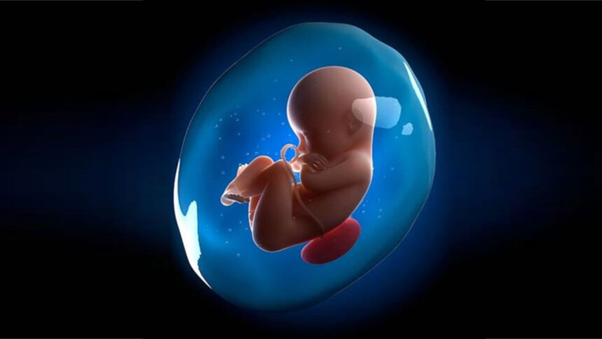 Amniotic-Fluid
