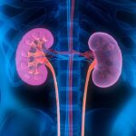 Kidney Failure