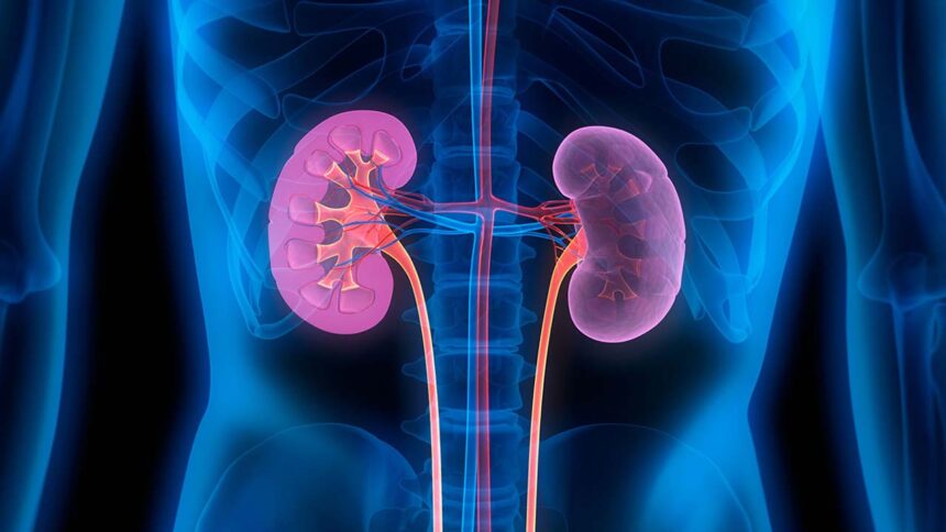 Kidney Failure