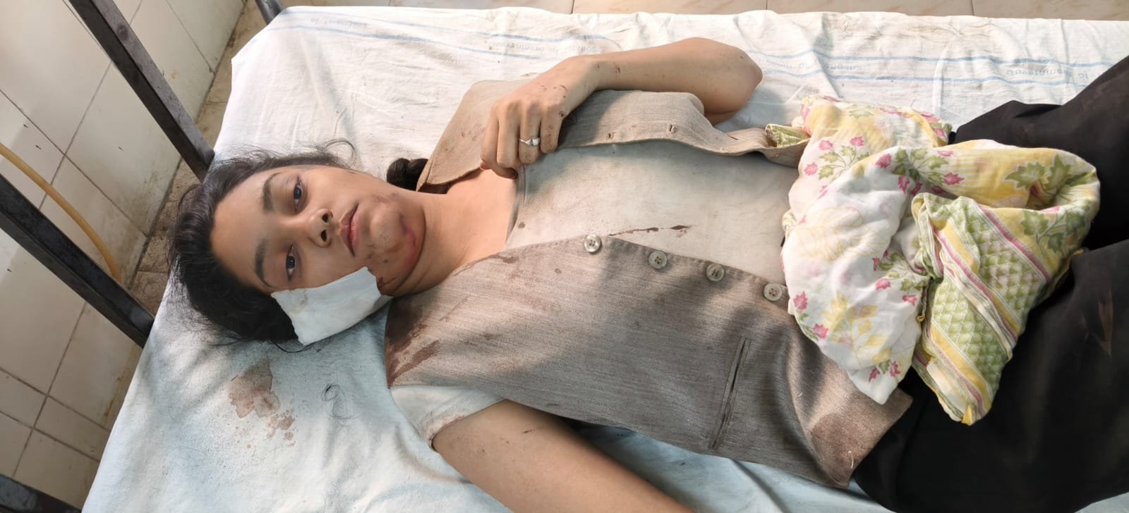 అతిది, అకోలా