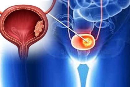 Bladder Cancer Symptoms | మూత్రంలో రక్తం కనిపిస్తోందా.. నిర్లక్ష్యం చేస్తే ఇక అంతే!