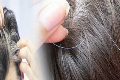 White Hair Myth | తెల్ల జుట్టును పీకేస్తే ఎక్కువ అవుతాయా.. అసలు నిజం ఇదే!