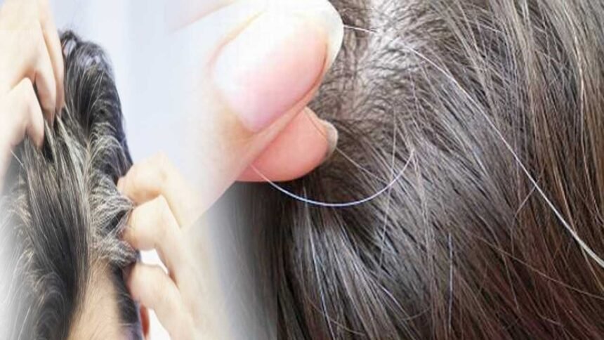 White Hair Myth | తెల్ల జుట్టును పీకేస్తే ఎక్కువ అవుతాయా.. అసలు నిజం ఇదే! 1 White Hair Myth | తెల్ల జుట్టును పీకేస్తే ఎక్కువ అవుతాయా.. అసలు నిజం ఇదే!