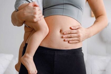 Cesarean Recovery Tips | సిజేరియన్ తర్వాత వచ్చే నీరసం, నొప్పులు.. ఈ సింపుల్ టిప్స్‌తో చెక్ పెట్టండి!