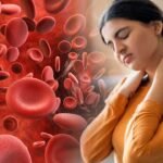 Iron Deficiency Women